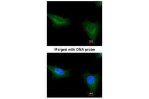 ICC/IF Image Immunofluorescence analysis of paraformaldehyde-fixed HeLa, using TTLL1, antibody at 1:200 dilution.