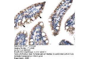 anti-Transcription Factor Dp-1 (TFDP1) (N-Term) antibody