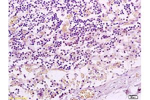 ABIN738816 PAR-2 IHC human colon