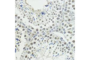 Immunohistochemistry of paraffin-embedded mouse testis using Phospho-Histone H3-T45 antibody (ABIN7267692) at dilution of 1:100 (40x lens).
