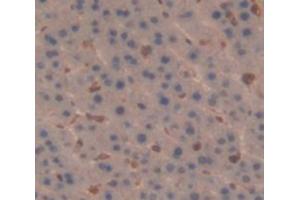 IHC-P analysis of Rat Tissue, with DAB staining. (IL-6 Receptor anticorps  (AA 19-108))
