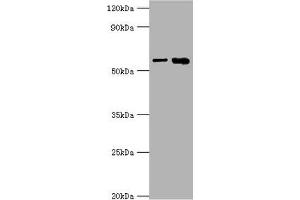 Western blot All lanes: IL1R1 antibody at 6 μg/mL Lane 1: Hela whole cell lysate Lane 2: Mouse heart tissue Secondary Goat polyclonal to rabbit IgG at 1/10000 dilution Predicted band size: 65 kDa Observed band size: 65 kDa