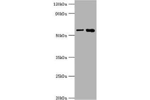 Western blot All lanes: IL1R1 antibody at 6 μg/mL Lane 1: Hela whole cell lysate Lane 2: Mouse heart tissue Secondary Goat polyclonal to rabbit IgG at 1/10000 dilution Predicted band size: 65 kDa Observed band size: 65 kDa (IL1R1 anticorps  (AA 18-320))