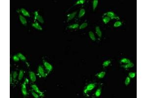 anti-Activator of Basal Transcription 1 (Abt1) (AA 197-270) antibody