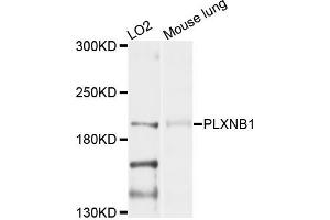 Western blot analysis of extracts of LO2 and mouse lung cells, using PLXNB1 antibody. (PLXNB1 anticorps)