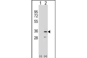 Western blot analysis of R (arrow) using rabbit polyclonal R Antibody (N-term) (ABIN653060 and ABIN2842661). (RPA2 anticorps  (N-Term))