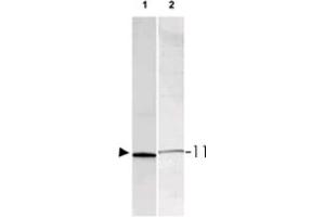 Western blot using S100A1/S100B polyclonal antibody  shows detection of a band ~11 KDa corresponding to bovine S100A1/S100B monomer (100 ng loaded, arrowhead lane 1). (S100A/B anticorps)