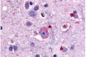 Anti-GRM1 / MGLUR1 antibody  ABIN1048925 IHC staining of human brain, neurons and glia. (Metabotropic Glutamate Receptor 1 anticorps  (N-Term))
