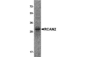 Western Blotting (WB) image for Regulator of Calcineurin 2 (RCAN2) (AA 2-197), (Isoform 2) protein (His tag) (ABIN2469007) (RCAN2 Protein (AA 2-197, Isoform 2) (His tag))