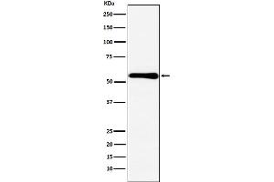 Western blot analysis of CBS expression in MCF7 cell lysate.