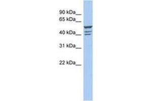 ZNF140 anticorps  (C-Term)