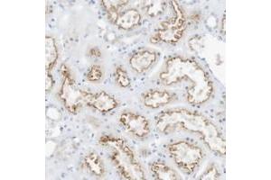 Immunohistochemical staining of human kidney with SPOCD1 polyclonal antibody  shows moderate luminal membrane positivity in cells of tubules at 1:50-1:200 dilution. (SPOCD1 anticorps)
