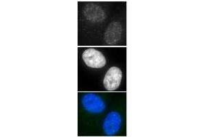 Immunofluorescence (IF) image for anti-DNA Repair Protein Homolog 1 (RAD51) antibody (ABIN2452093)