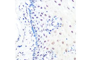 Immunohistochemistry of paraffin-embedded human esophageal using KLF4 Rabbit mAb (ABIN7268157) at dilution of 1:100 (40x lens).