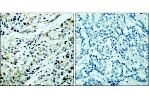 Immunohistochemistry (IHC) image for anti-Histone Deacetylase 5 (HDAC5) (pSer498) antibody (ABIN2888430) (HDAC5 anticorps  (pSer498))