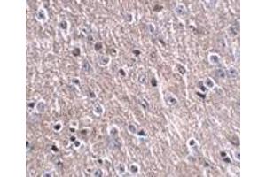 Immunohistochemistry of FNIP2 in mouse brain tissue with FNIP2 antibody at 2. (CDIP1 anticorps  (Center))