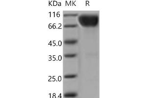 Western Blotting (WB) image for Interleukin 17 Receptor A (IL17RA) (Active) protein (Fc Tag) (ABIN7196415)