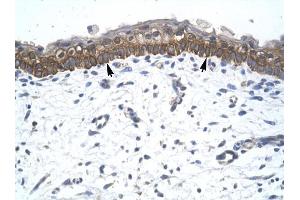 ZNF385 antibody was used for immunohistochemistry at a concentration of 4-8 ug/ml to stain Epidermal cells (arrows) in Human Skin. (ZNF385A anticorps  (C-Term))