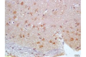 Formalin-fixed and paraffin embedded rat brain labeled with Anti-Calbindin/Calbindin D28k Polyclonal Antibody, Unconjugated (ABIN703691) at 1:200 followed by conjugation to the secondary antibody and DAB staining (CALB1 anticorps)
