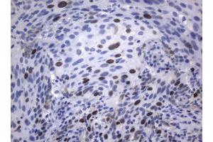 Image no. 3 for anti-Antigen Identified By Monoclonal Antibody Ki-67 (MKI67) (AA 1160-1493) antibody (ABIN1490860) (Ki-67 anticorps  (AA 1160-1493))