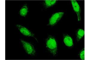 Immunofluorescence of monoclonal antibody to C18orf23 on HeLa cell. (C18orf23 anticorps  (AA 122-220))