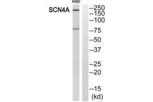 Western blot analysis of extracts from K562 cells, using SCN4A antibody. (SCN4A anticorps)