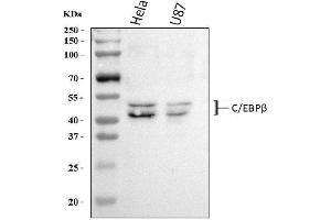 Western blot analysis of CEBP Beta using anti-CEBP Beta antibody (ABIN3043809).