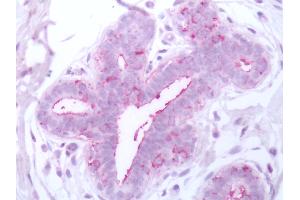 Human Breast: Formalin-Fixed, Paraffin-Embedded (FFPE)