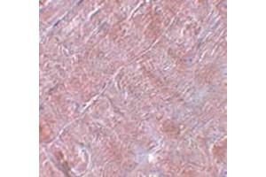Immunohistochemistry staining in human skeletal muscle tissue with RANBP10 Antibody  at 5 μg/ml.