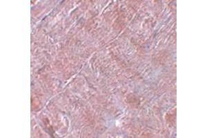 Immunohistochemistry staining in human skeletal muscle tissue with RANBP10 Antibody  at 5 μg/ml. (RANBP10 anticorps  (Center))