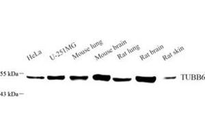 Western blot analysis of TUBB6 (ABIN7076054) at dilution of 1: 3000