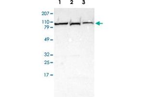 Western blot analysis of Lane 1: Human cell line RT-4 Lane 2: Human cell line EFO-21 Lane 3: Human cell line A-431 with PYGL polyclonal antibody  at 1:250-1:500 dilution. (PYGL anticorps)