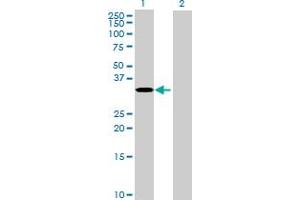 Western Blot analysis of RPUSD1 expression in transfected 293T cell line by RPUSD1 MaxPab polyclonal antibody. (RPUSD1 anticorps  (AA 1-312))