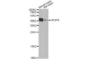 Western blot analysis of extracts of various cell lines, using VEGFB Antibody (ABIN5971159) at 1/1000 dilution. (VEGFB anticorps)