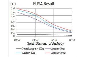 Black line: Control Antigen (100 ng), Purple line: Antigen(10 ng), Blue line: Antigen (50 ng), Red line: Antigen (100 ng), (KBTBD8 anticorps  (AA 264-464))