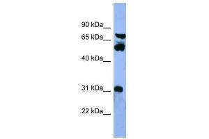 Western Blot showing CYP8B1 antibody used at a concentration of 1-2 ug/ml to detect its target protein.