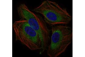 Flow cytometric analysis of HeLa cells using CD59 antibody (green) and negative control (red). (CD59 anticorps  (AA 31-111))
