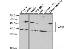 Western blot analysis of extracts of various cell lines using VAPB Polyclonal Antibody at dilution of 1:1000. (VAPB anticorps)