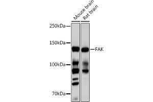 Western blot analysis of extracts of various cell lines, using FAK pAb (ABIN6131637, ABIN6135867, ABIN6135868 and ABIN7101374) at 1:1000 dilution. (FAK anticorps)