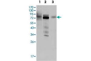 Western blot analysis using MDM4 monoclonal antobody, clone 2D10F4  against HeLa (1), A-549 (2) and A-431 (3) cell lysate. (MDM4-binding Protein anticorps)