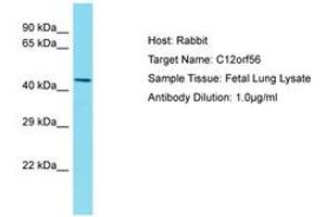 Image no. 1 for anti-Chromosome 12 Open Reading Frame 56 (C12ORF56) (AA 77-126) antibody (ABIN6750551) (C12orf56 anticorps  (AA 77-126))
