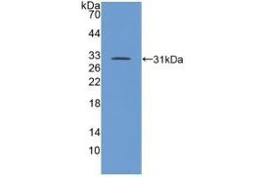Detection of Recombinant TGFbR1, Human using Polyclonal Antibody to Transforming Growth Factor Beta Receptor I (TGFbR1)