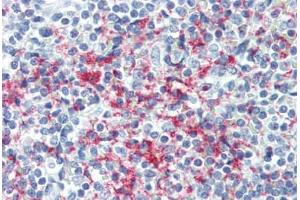 Human Spleen (formalin-fixed, paraffin-embedded) stained with GP1BB antibody ABIN396968 at 1:50 followed by biotinylated anti-mouse IgG secondary antibody ABIN481714, alkaline phosphatase-streptavidin and chromogen.