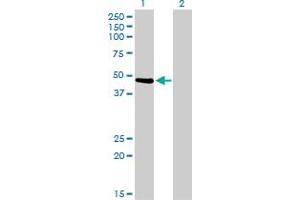 Western Blot analysis of PTK9 expression in transfected 293T cell line by PTK9 monoclonal antibody (M05), clone 1D12.