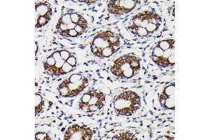 Immunohistochemistry of paraffin-embedded human colon using Monoamine Oxidase B (MAOB) Rabbit pAb (ABIN3022151, ABIN3022152, ABIN3022153, ABIN1513172 and ABIN6218632) at dilution of 1:150 (40x lens).