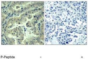 Image no. 1 for anti-Eukaryotic Translation Initiation Factor 4 Gamma, 1 (EIF4G1) (pSer1232) antibody (ABIN319277) (EIF4G1 anticorps  (pSer1232))