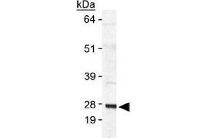 Western blot analysis of SAT1 in human SAT1 transfected lysate using with SAT1 polyclonal antibody . (SAT1 anticorps  (AA 100-171))