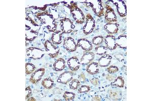 Immunohistochemistry of paraffin-embedded rat kidney using UQCRFS1 Rabbit pAb (ABIN6131106, ABIN6149963, ABIN6149965 and ABIN6222528) at dilution of 1:100 (40x lens). (UQCRFS1 anticorps  (AA 79-274))