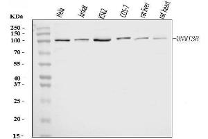 Western blot analysis of DNMT3B using anti-DNMT3B antibody (ABIN7600274).