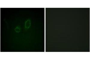 Immunofluorescence analysis of A549 cells, using Moesin/Ezrin/Radixin (Phospho-Thr558) Antibody. (Moesin/ezrin/radixin (AA 524-573), (pThr558) anticorps)